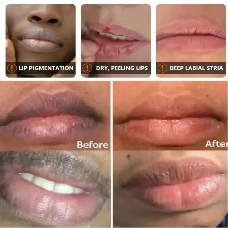 Remove Dark Lip Balm Lightening Melanin Mask Gloss.
