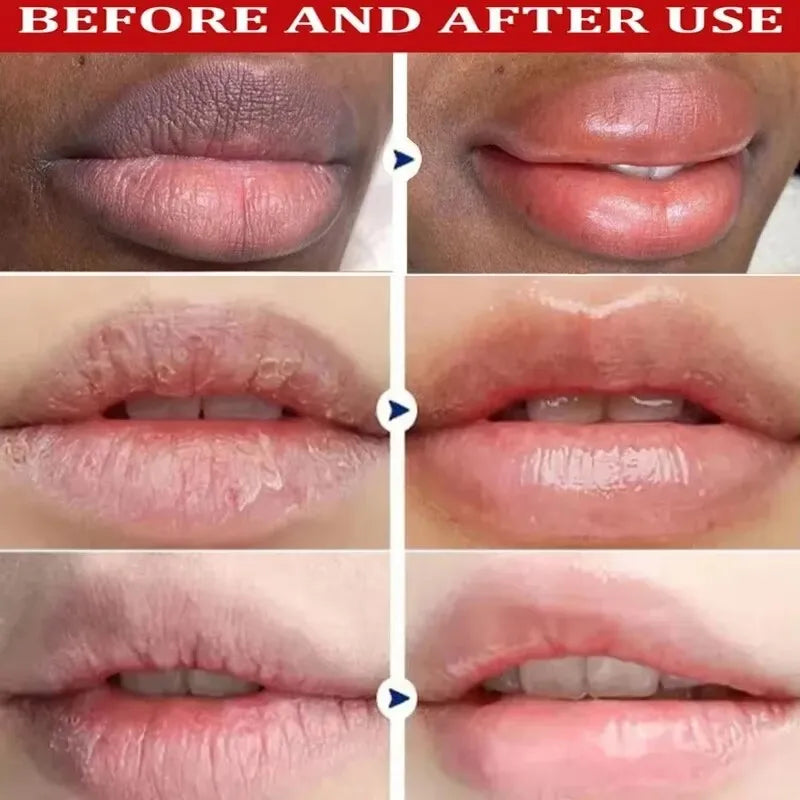 Remove Dark Lip Balm Lightening Melanin Mask Gloss.